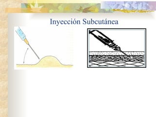 Inyección Subcutánea
 