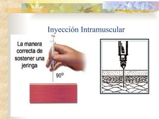 Inyección Intramuscular
 