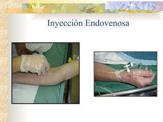 Inyección Endovenosa
 