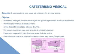 CATETERISMO VESICAL
Conceito: É a introdução de uma sonda até a bexiga a fim de retirar a urina.
Objetivo:
➢
Promover a drenagem de urina em situações em que há impedimento da micção espontânea.
➢
Monitorização contínua do débito urinário;
➢
Aliviar distensão vesical pela retenção de urina;
➢
Em casos excepcionais para obter amostra de urina para exames;
➢
Preparo pré – operatório, para diminuir o perigo de lesão vesical;
➢
Para evitar que o paciente urine de forma espontânea após operações perineais.
 