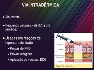 VIA INTRADÉRMICA
Via restrita;
Pequenos volumes – de 0,1 a 0,5
mililitros;
Usadas em reações de
hipersensibilidade
Provas de PPD
Provas alérgicas
Aplicação de vacinas: BCG
 
