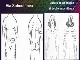Via Subcutânea
Locais de Aplicação
(injeção subcutânea)
 