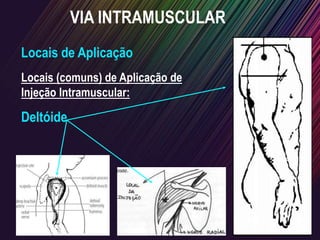 VIA INTRAMUSCULAR
Locais de Aplicação
Locais (comuns) de Aplicação de
Injeção Intramuscular:
Deltóide
 