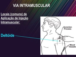 Locais (comuns) de
Aplicação de Injeção
Intramuscular:
Deltóide
VIA INTRAMUSCULAR
 