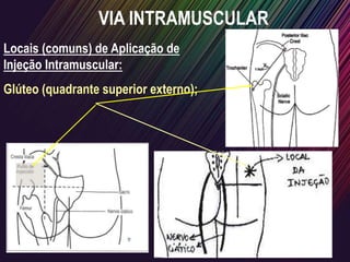 Locais (comuns) de Aplicação de
Injeção Intramuscular:
Glúteo (quadrante superior externo);
VIA INTRAMUSCULAR
 