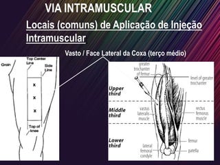 VIA INTRAMUSCULAR
Locais (comuns) de Aplicação de Injeção
Intramuscular:
Vasto / Face Lateral da Coxa (terço médio)
 