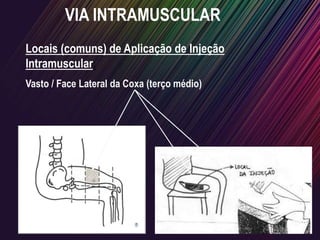 VIA INTRAMUSCULAR
Locais (comuns) de Aplicação de Injeção
Intramuscular:
Vasto / Face Lateral da Coxa (terço médio)
 