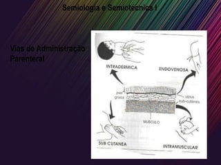 Semiologia e Semiotécnica I
Vias de Administração
Parenteral
 
