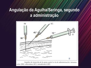 Angulação da Agulha/Seringa, segundo
a administração
 