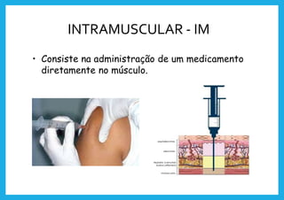 INTRAMUSCULAR - IM
• Consiste na administração de um medicamento
diretamente no músculo.
 
