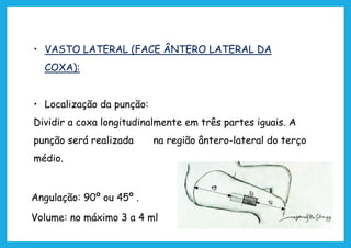 • VASTO LATERAL (FACE ÂNTERO LATERAL DA
COXA):
• Localização da punção:
Dividir a coxa longitudinalmente em três partes iguais. A
punção será realizada na região ântero-lateral do terço
médio.
Angulação: 90º ou 45º .
Volume: no máximo 3 a 4 ml
 