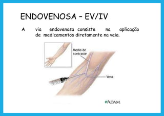 ENDOVENOSA – EV/IV
A via endovenosa consiste na aplicação
de medicamentos diretamente na veia.
 