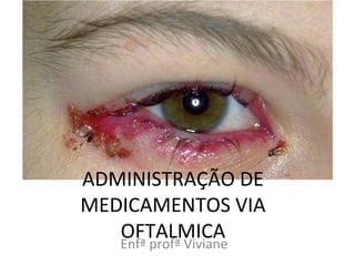 ADMINISTRAÇÃO DE
MEDICAMENTOS VIA
OFTALMICAEnfª profª Viviane
 