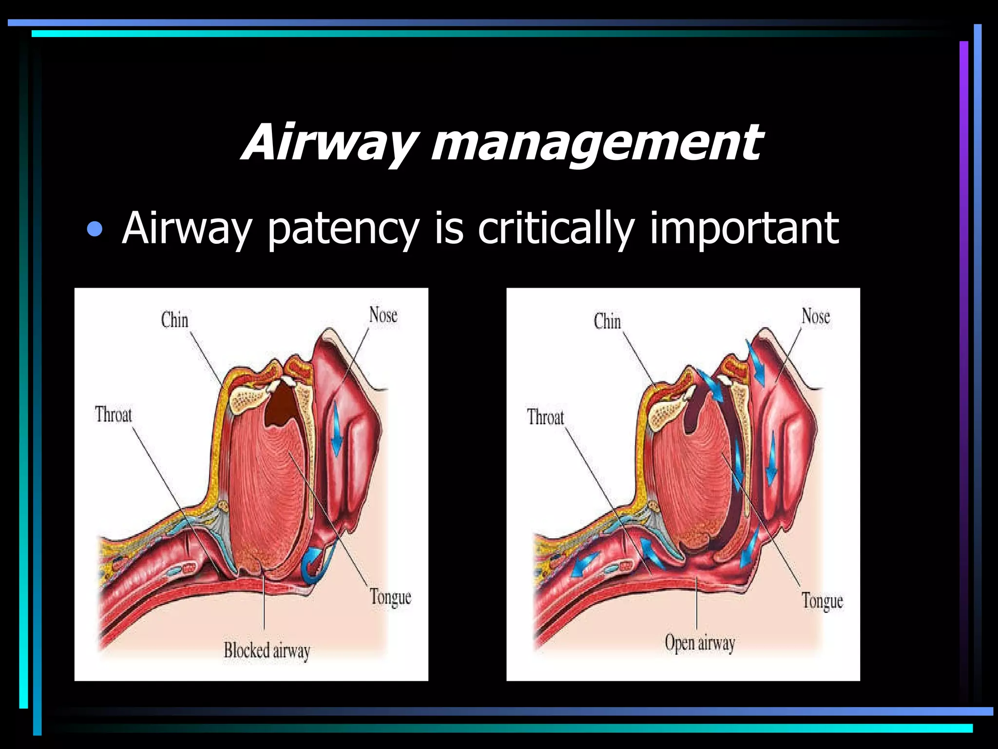 Airway management Airway patency is critically important 