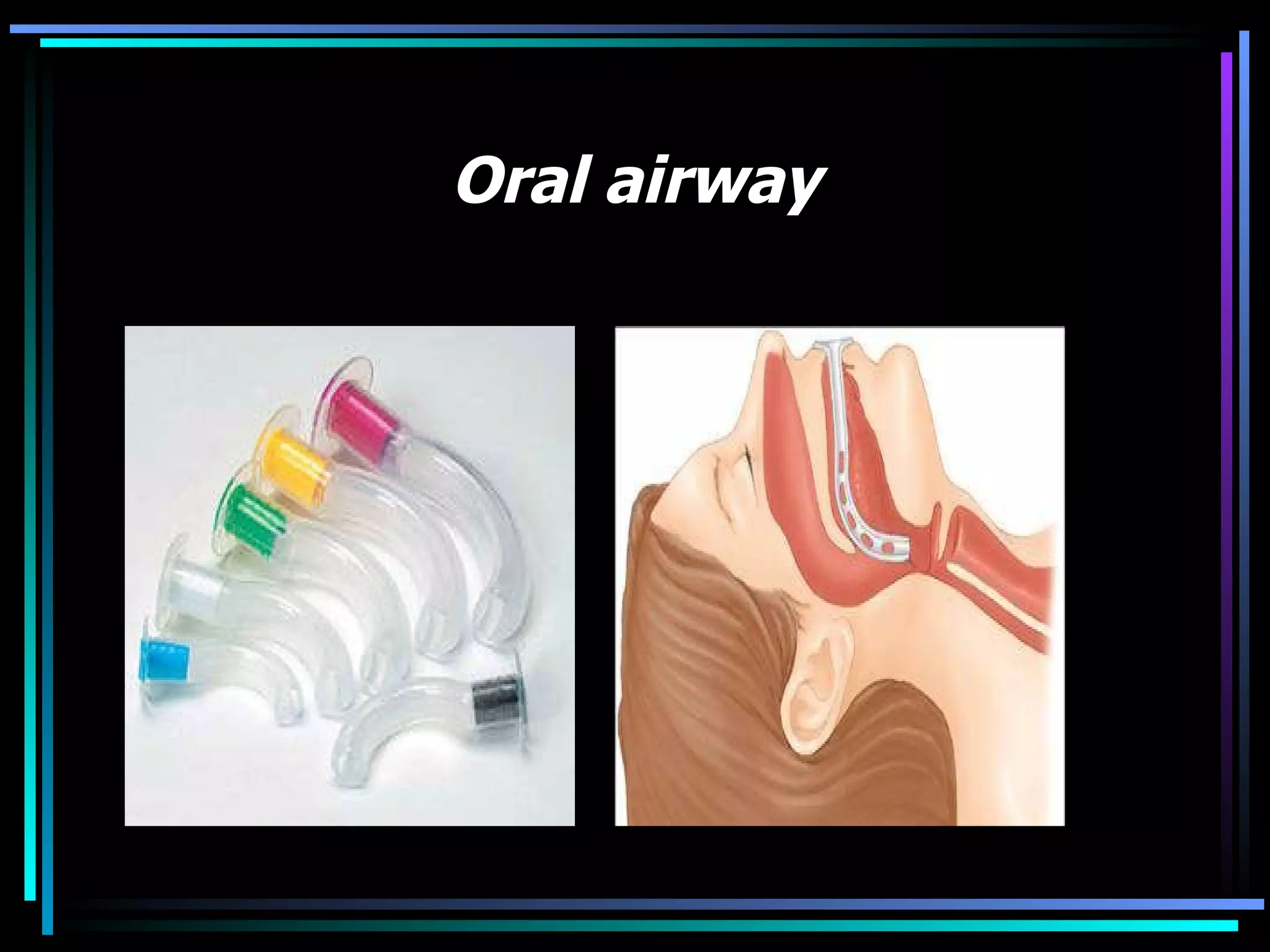 Oral airway 