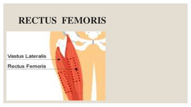 Relmus Injection Rectus Femoris Injections : Injection intramusculaire (IM) – SGDX