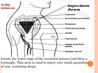 Administration of injection.ppt prepared by drug. Milka | PPT