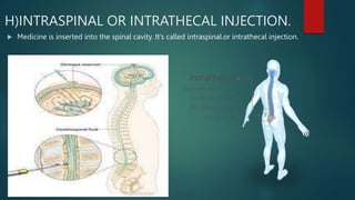Intrahecal Injection ADMINISTRATION OF INJECTION by ram.pptx