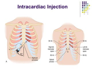 Intracardiac Injection