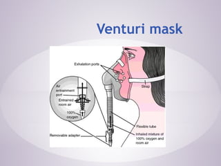 Ventry Mask Administration of Oxygen Using Venturi Mask.pptx