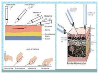 Partement Injection Administration of parentral medication | PPTX
