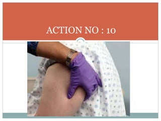 ACTION NO : 10
 