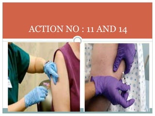 ACTION NO : 11 AND 14
 