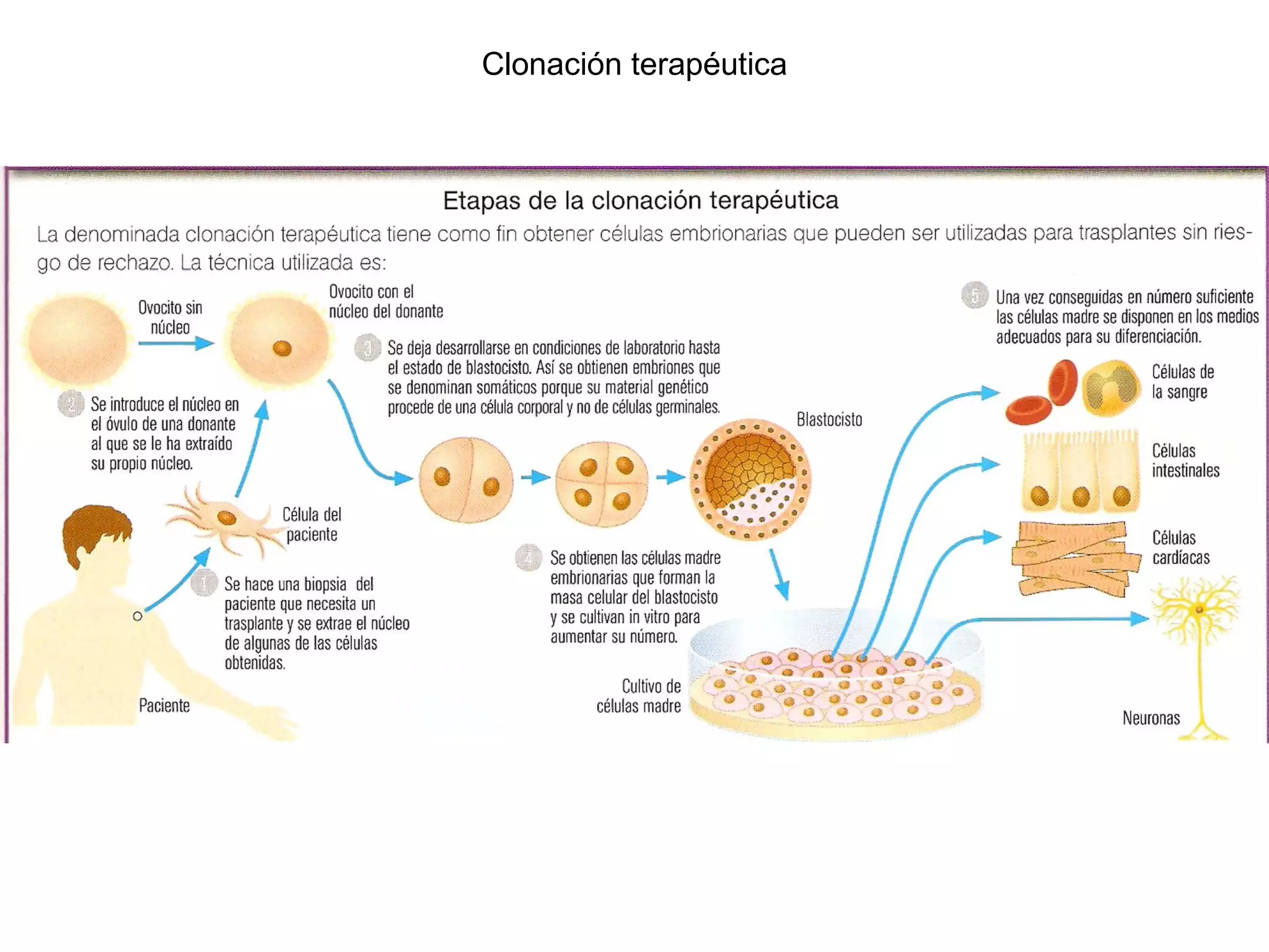 Clonación terapéutica
 