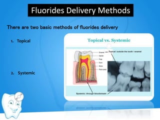 Fluorides Delivery Methods
1. Topical
2. Systemic
There are two basic methods of fluorides delivery
 