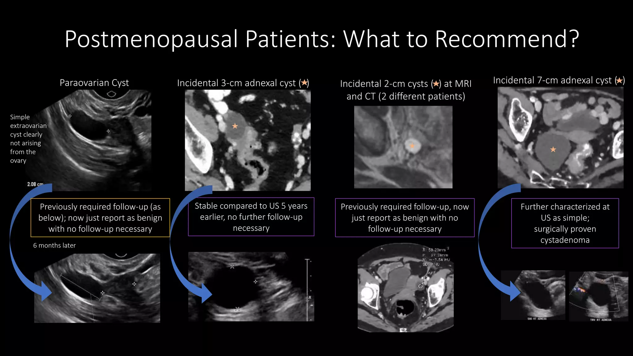 Adnexal cysts.pptx