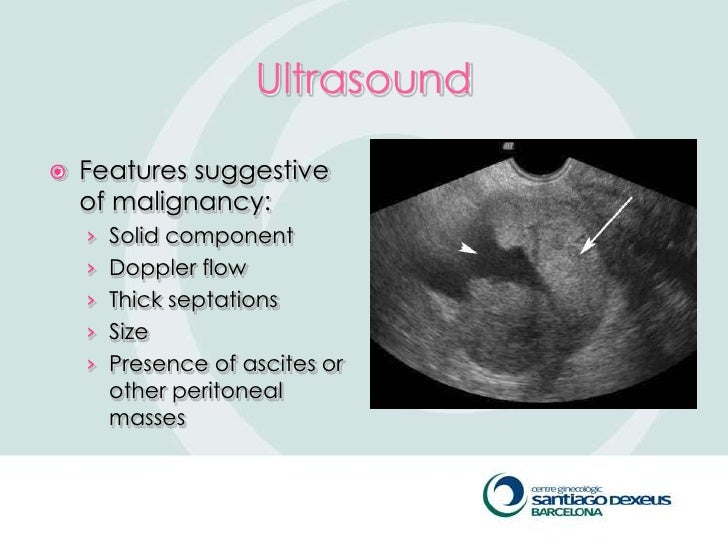 Download Malignant Adnexal Mass Ultrasound Background