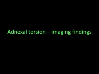 Adnexal torsion – imaging findings
 