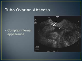 • Complex internal
  appearance
 