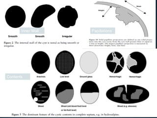 Inner Wall   Papillations




Contents
 