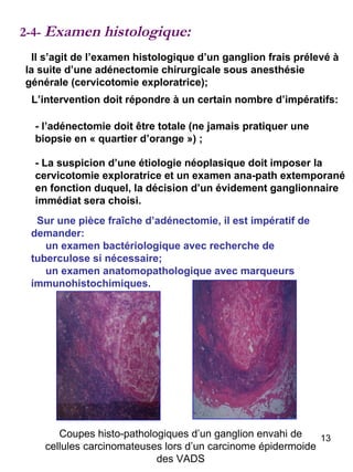 2-4-  Examen histologique: Il s’agit de l’examen histologique d’un ganglion frais prélevé à la suite d’une adénectomie chirurgicale sous anesthésie générale (cervicotomie exploratrice);  L’intervention doit répondre à un certain nombre d’impératifs:  - l’adénectomie doit être totale (ne jamais pratiquer une biopsie en « quartier d’orange ») ; - La suspicion d’une étiologie néoplasique doit imposer la cervicotomie exploratrice et un examen ana-path extemporané en fonction duquel, la décision d’un évidement ganglionnaire immédiat sera choisi. Sur une pièce fraîche d’adénectomie, il est impératif de demander:  un examen bactériologique avec recherche de tuberculose si nécessaire; un examen anatomopathologique avec marqueurs immunohistochimiques. Coupes histo-pathologiques d’un ganglion envahi de cellules carcinomateuses lors d’un carcinome épidermoide des VADS 