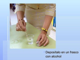 Deposítalo en un frasco con alcohol