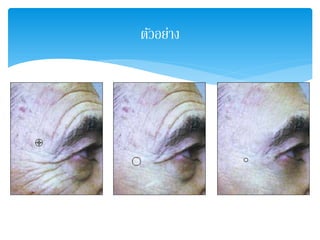 ตัวอย่าง
 