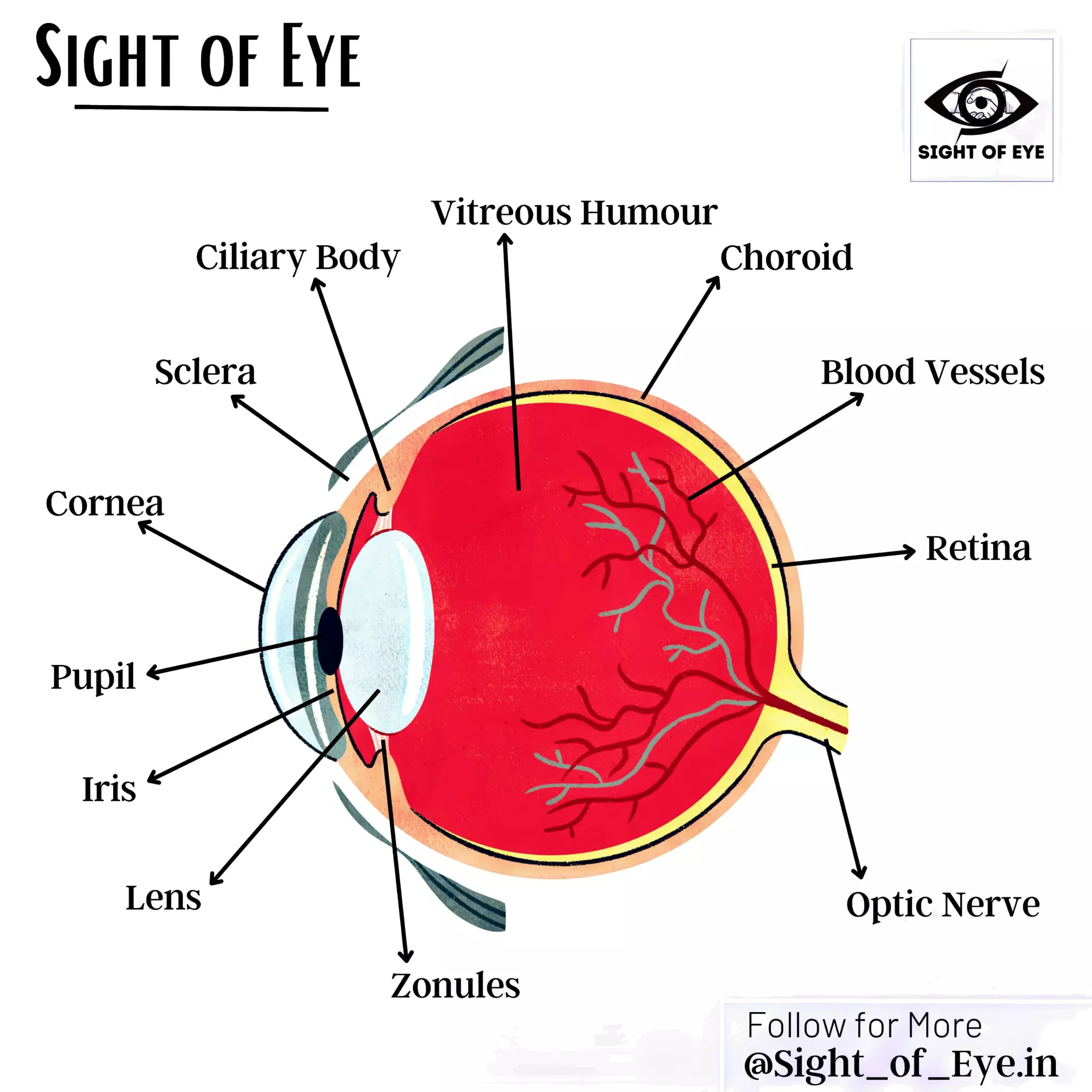 SIGHT OF EYE
SIGHT OFEYE
Vitreous Humour
Ciliary Body Choroid
Sclera Blood Vessels
Cornea
Retina
Pupil
Iris
Lens Optic Nerve
Zonules
Follow for More
@Sight_of_Eye.in