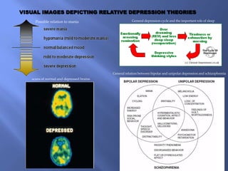VISUAL IMAGES DEPICTING RELATIVE DEPRESSION THEORIES
     Possible relation to mania                       General depression cycle and the important role of sleep




                                          General relation between bipolar and unipolar depression and schizophrenia
   scans of normal and depressed brains
 