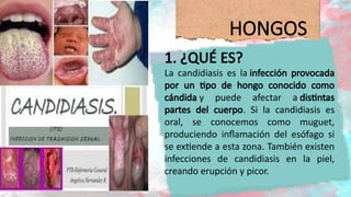 salud sexual reproductiva en adolesentes | PPTX