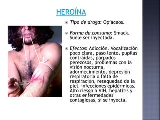  Tipo de droga: Opiáceos.
 Forma de consumo: Smack.
Suele ser inyectada.
 Efectos: Adicción. Vocalización
poco clara, paso lento, pupilas
contraídas, párpados
perezosos, problemas con la
visión nocturna,
adormecimiento, depresión
respiratoria o falta de
respiración, resequedad de la
piel, infecciones epidérmicas.
Alto riesgo a VIH, hepatitis y
otras enfermedades
contagiosas, si se inyecta.
 