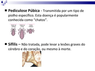 Pediculose Púbica  -  Transmitida por um tipo de piolho específico. Esta doença é popularmente conhecida como “chatos”. Sífilis  –  Não tratada, pode levar a lesões graves do cérebro e do coração, ou mesmo à morte. 