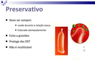 Preservativo Deve ser sempre: usado durante a relação sexual Colocado atempadamente Evita a gravidez Protege das DST Não é reutilizável 