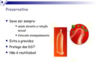 Preservativo
 Deve ser sempre:
 usado durante a relação
sexual
 Colocado atempadamente
 Evita a gravidez
 Protege das DST
 Não é reutilizável
 