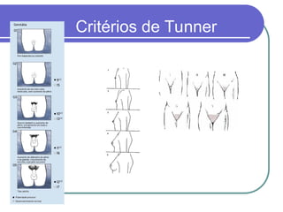Critérios de Tunner
 