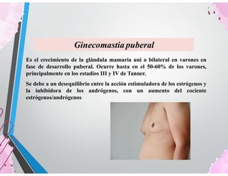 Ginecomastia puberal
Es el crecimiento de la glándula mamaria uni o bilateral en varones en
fase de desarrollo puberal. Ocurre hasta en el 50-60% de los varones,
principalmente en los estadios III y IV de Tanner.
Se debe a un desequilibrio entre la acción estimuladora de los estrógenos y
la inhibidora de los andrógenos, con un aumento del cociente
estrógenos/andrógenos
 