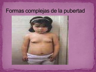 El púber ( vello púbico y axilar ).