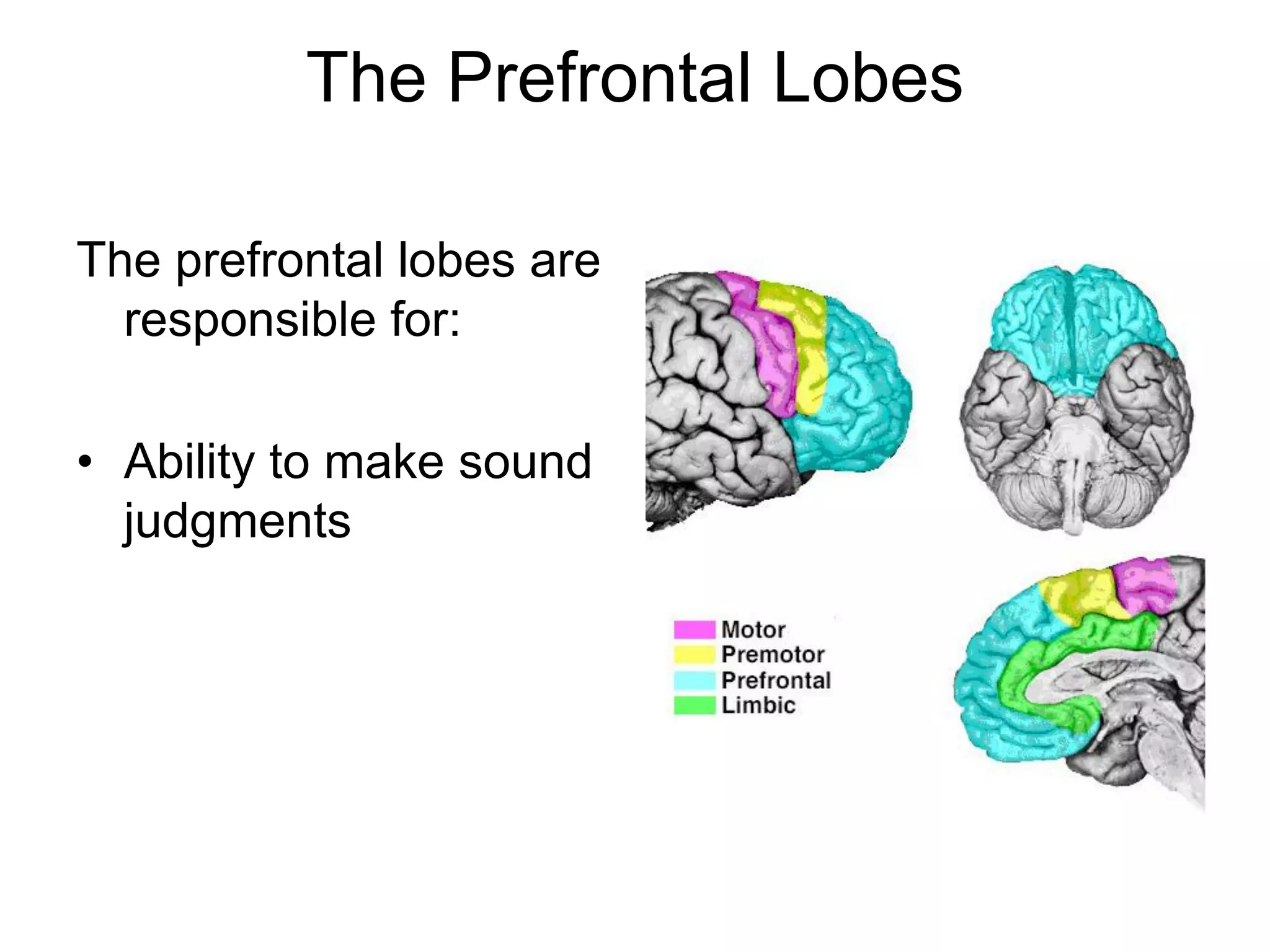The Prefrontal Lobes

The prefrontal lobes are
  responsible for:

• Ability to make sound
  judgments
 