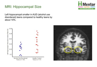 The Developing Brain, Adolescence and Vulnerability to Drug Abuse | PDF
