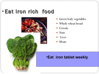 Eat iron rich  food Green leafy vegetables Whole wheat bread Cereals Nuts Liver Meats Eat  iron tablet weekly   